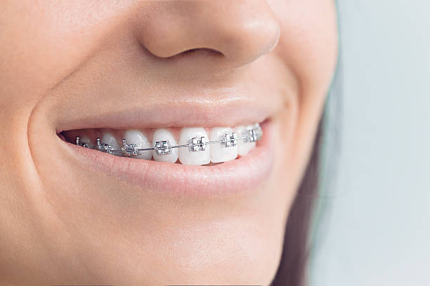 Best Veneers and Lumineers  in Exeter, CA